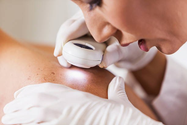 Dermatology