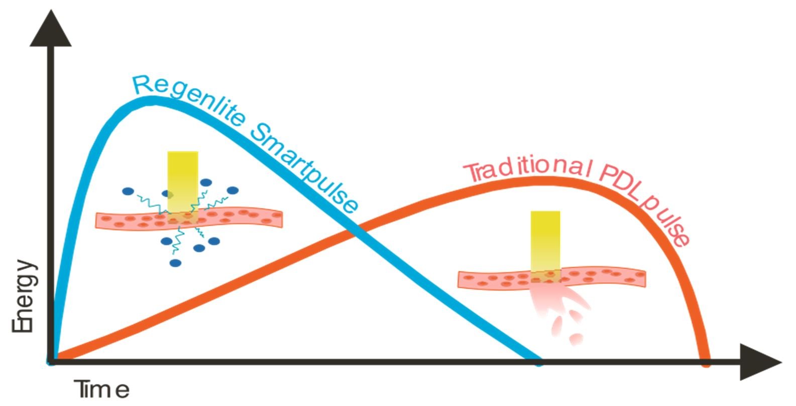 Figure 1. Pulse wave of Regenlite laser compared to traditional pulsed dye laser